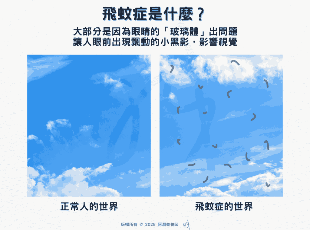 飛蚊症是什麼？