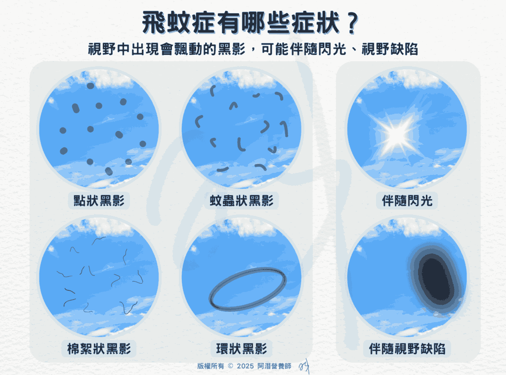 飛蚊症有哪些症狀？